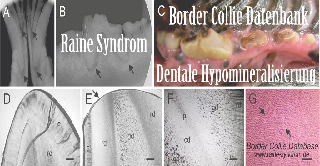 Copyright: © 2016 Hytönen et al. This is an openaccess article distributed under the terms of theCreative Commons Attribution License, which permitsunrestricted use, distribution, and reproduction in anymedium, provided the original author and source arecredited.Data Availability Statement: The genome data isfreely available under accession no. PRJEB13723(http://www.ebi.ac.uk/ena/data/view/PRJEB13723)atthe European Nucleotide Archive and accession no.SRP074053 at the NCBI Sequence Read Archive  (PDF) Molecular Characterization of Three Canine Models of Human Rare Bone Diseases: Caffey, van den Ende-Gupta, and Raine Syndromes. Available from: https://www.researchgate.net/publication/303326967_Molecular_Characterization_of_Three_Canine_Models_of_Human_Rare_Bone_Diseases_Caffey_van_den_Ende-Gupta_and_Raine_Syndromes [accessed Aug 29 2018].